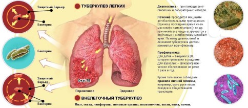 Ежегодная флюорография